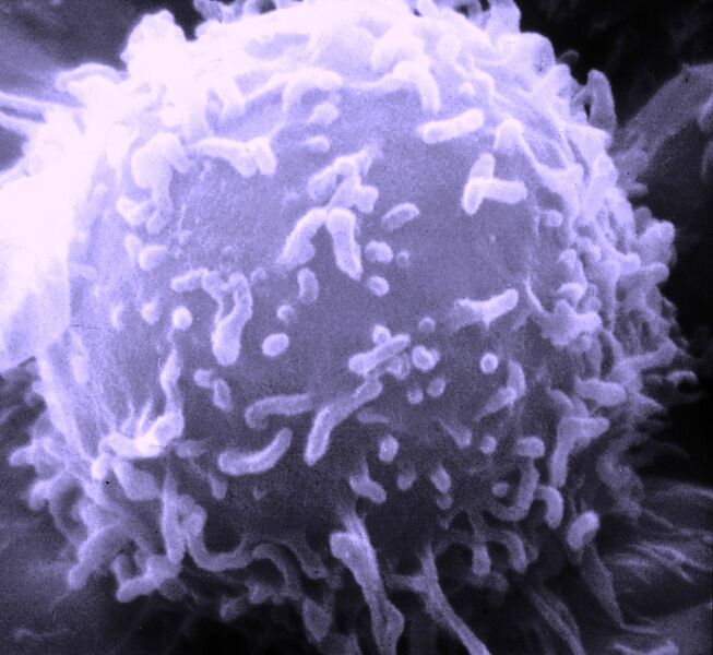 Datei:SEM Lymphocyte.jpg